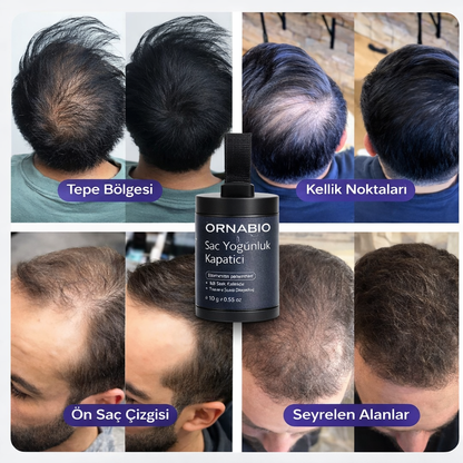 Doğal Görünümlü Saç Dolgusu®